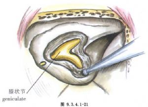 湖南建立禽流感疫情防控联动机制-008pg国际官网版